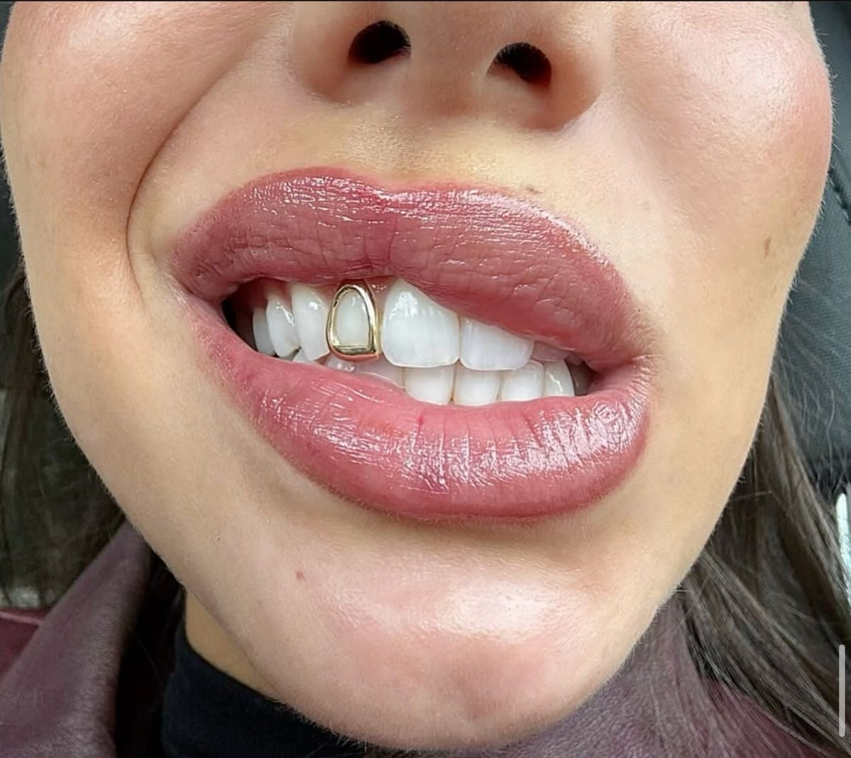 Bite Club Teeth Grillz
