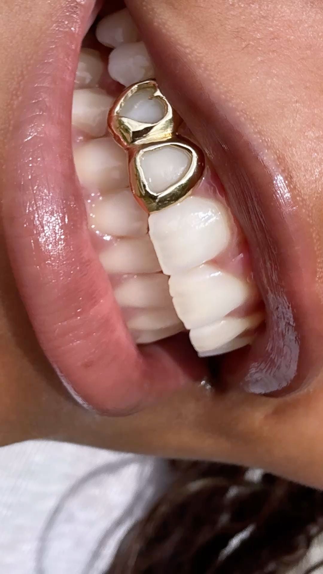 Double trouble Teeth grillz
