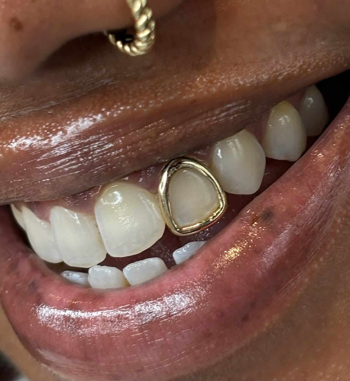 Bite Club Teeth Grillz