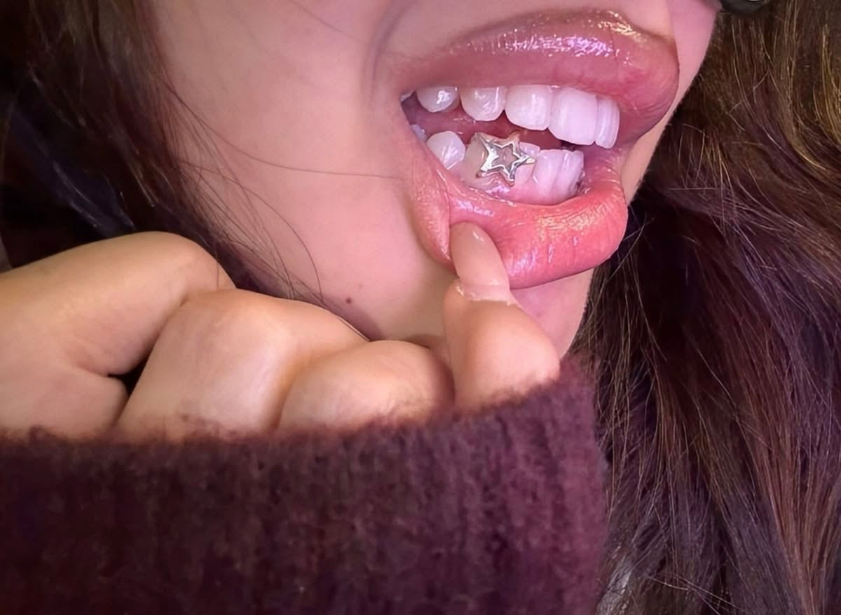 Star Teeth Grillz